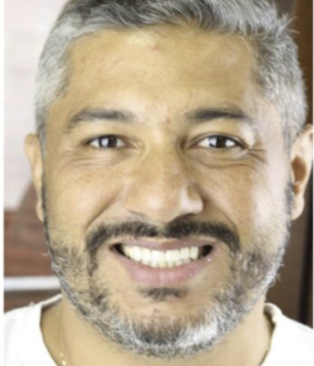 Carlos M., 62 anos — depois