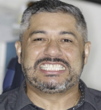 Carlos M., 62 anos — antes
