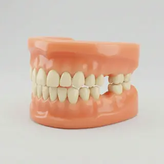 Perdi muitos dentes